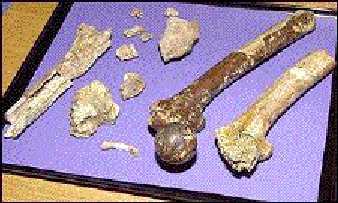 leg bones