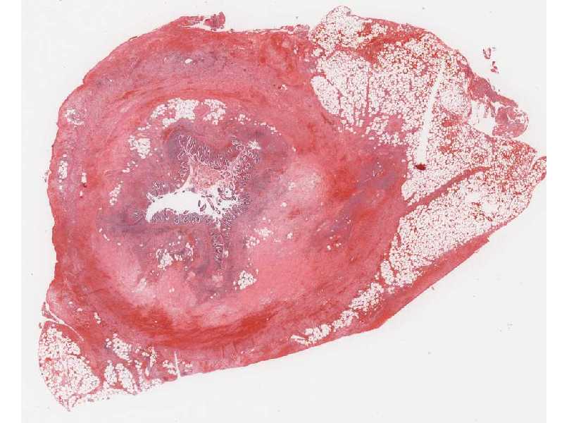 Appendix