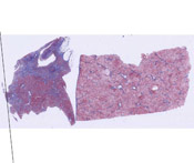 trichrome