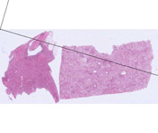 hematoxylin and eosin