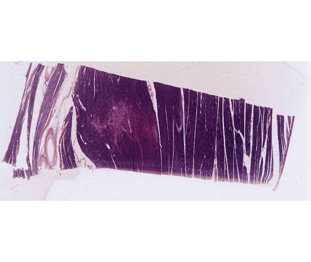 #15 Skeletal muscle (Phosphotungstic Acid � Hematoxylin, PTAH)