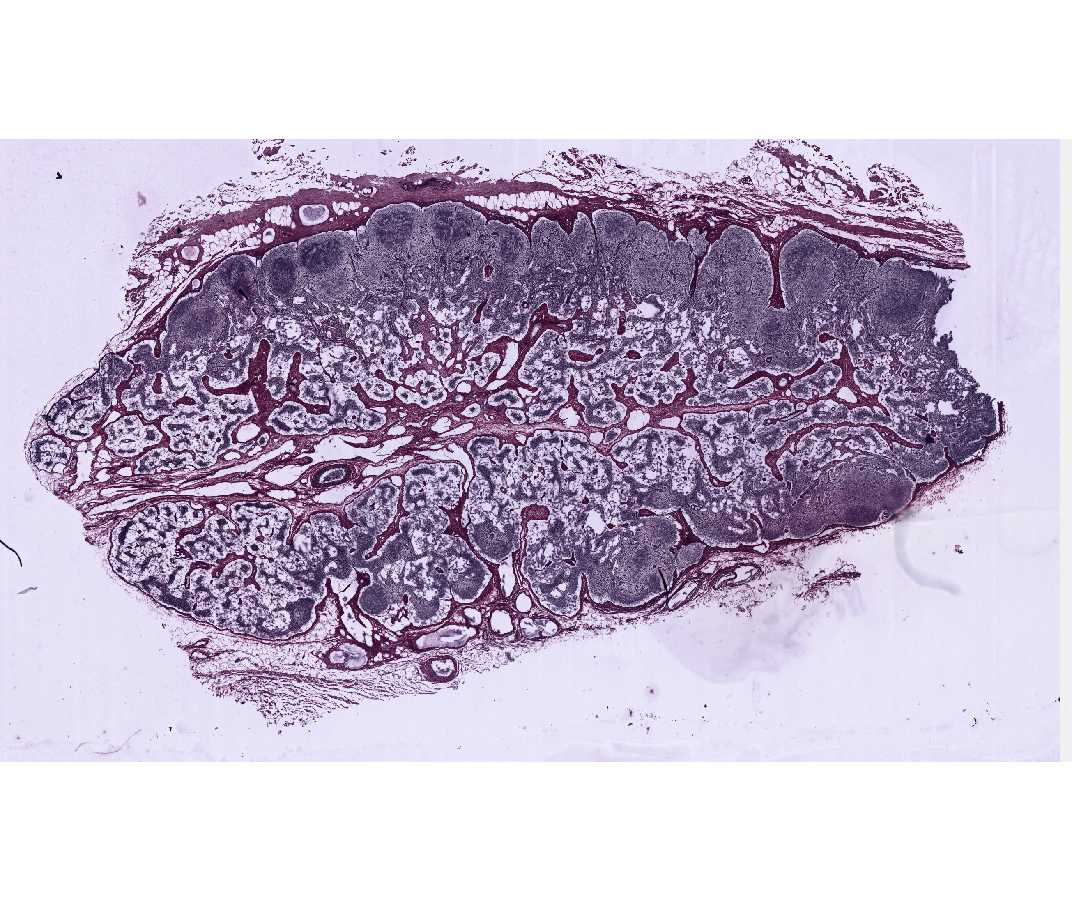 #22 Lymph node, Dog, Reticular Tissue