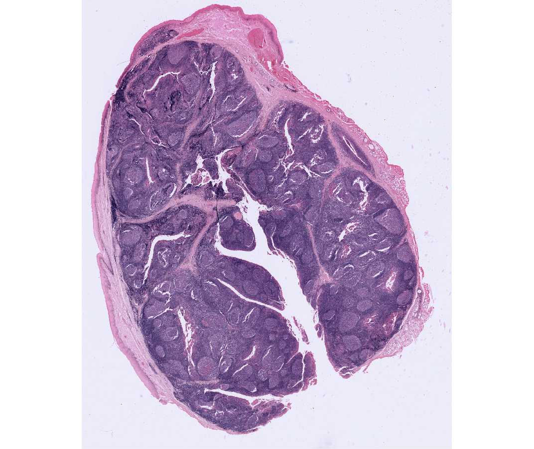 &nbsp;#24 Lymph node. Cat injected with India ink through lymphatic system