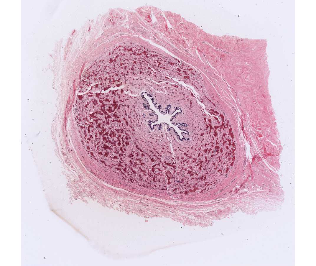 #55 Corpus spongiosum of penis, Human or Rabbit  