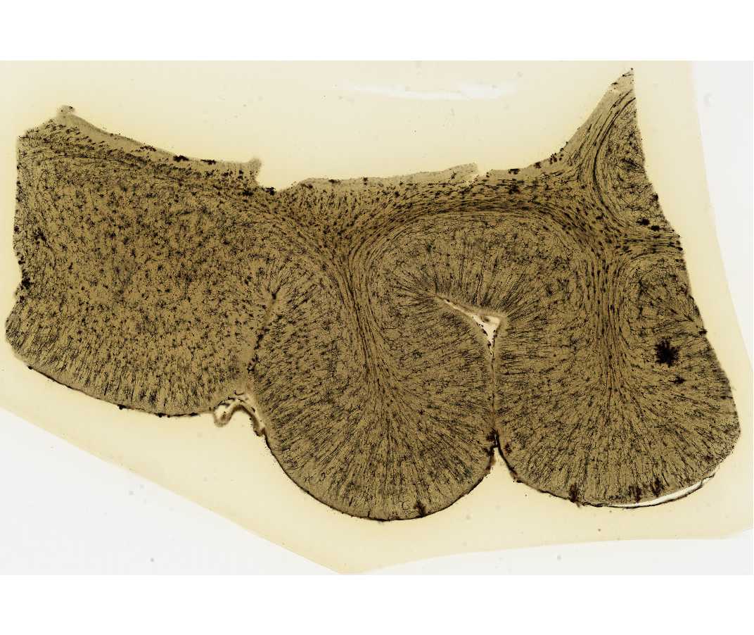 #111 Cerebral Cortex, Cat, Golgi, 100�m, Celloidin embedded