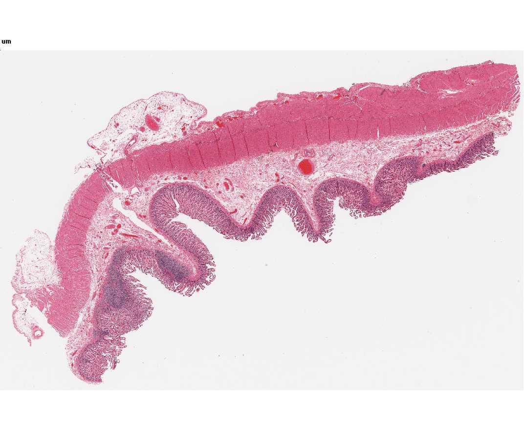 #117 Small intestine H&E