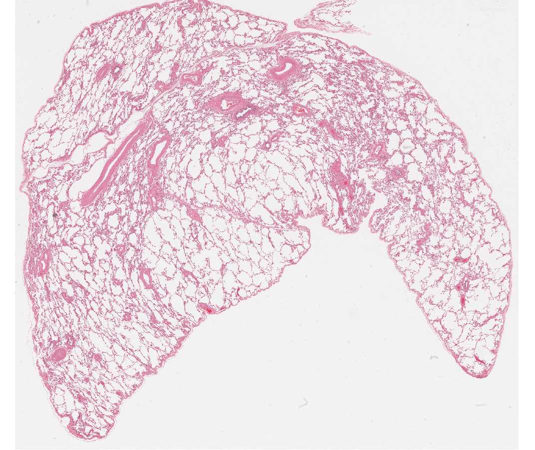 #118 Lung, Human H&E