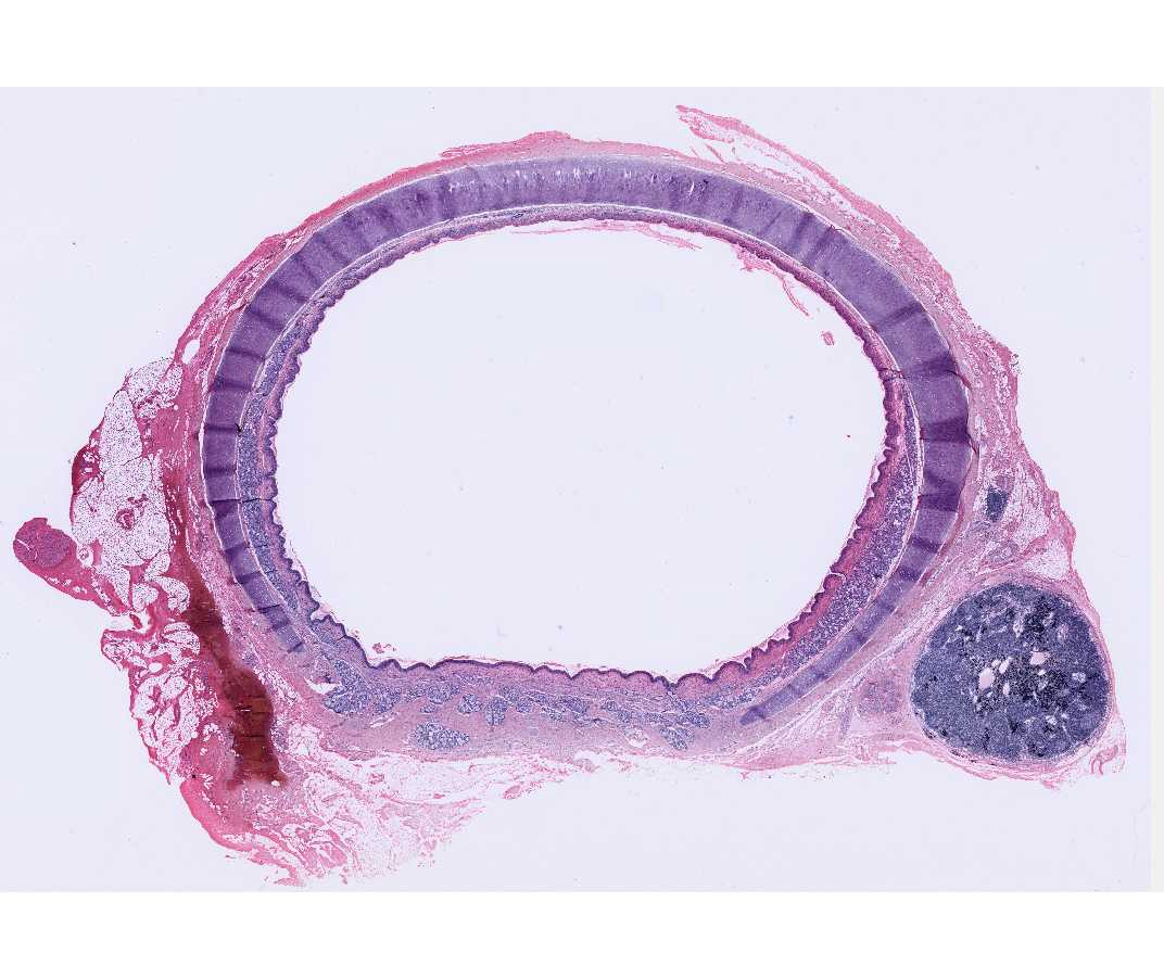 #5 Trachea, H&E 