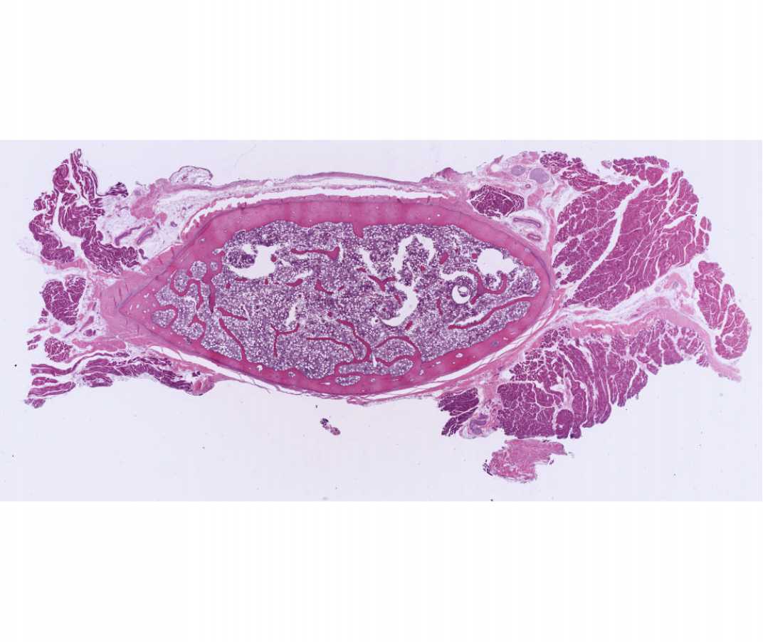  Rib, cross section, H&E 