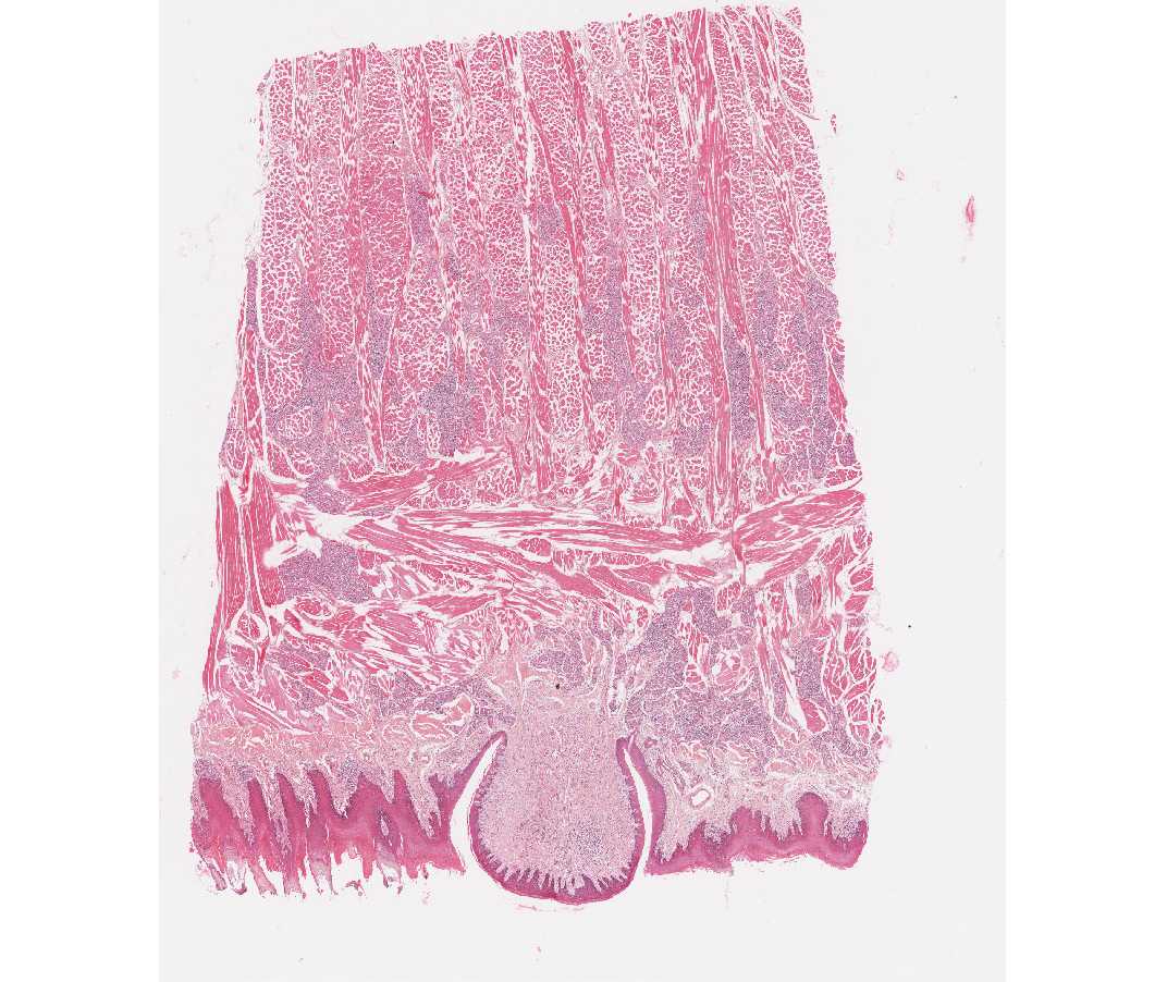#10 Shaft of Long Bone, Cross Section, H&E 