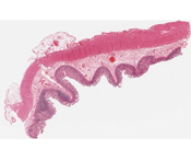 #117 Small intestine, H&E
